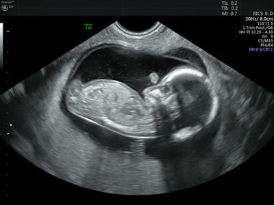ijmrr_1233_02.jpg