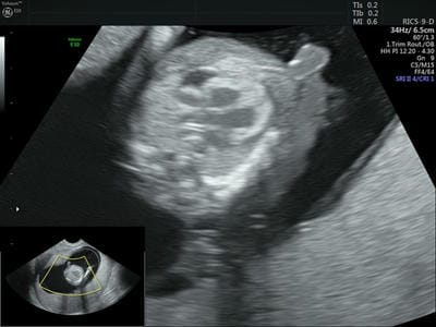 ijmrr_1233_03.jpg
