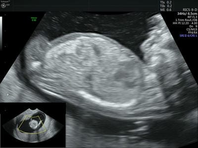 ijmrr_1233_04.jpg