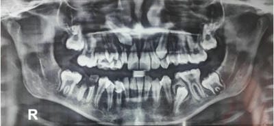 ijmrr_1436_03.JPG