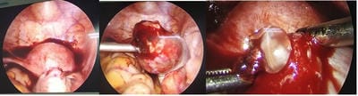 obsgyne_158_01.JPG