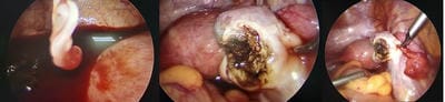 obsgyne_158_02.JPG