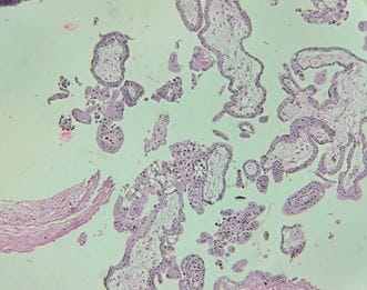 obsgyne_158_04.JPG