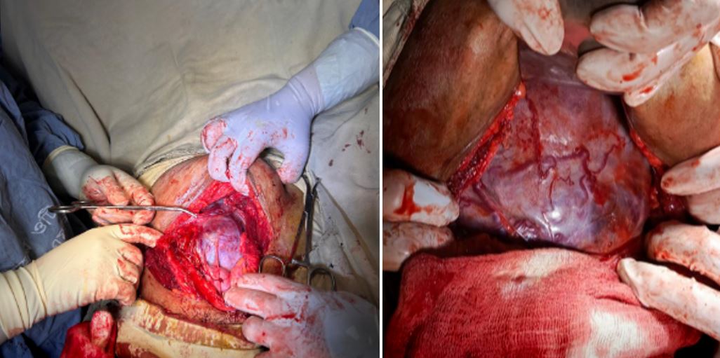 obstetrics-171-01.JPG