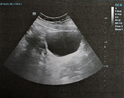 obstetrics-179-01.JPG