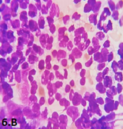 patho-680-13..JPG