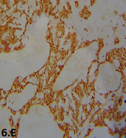 patho-680-16..JPG