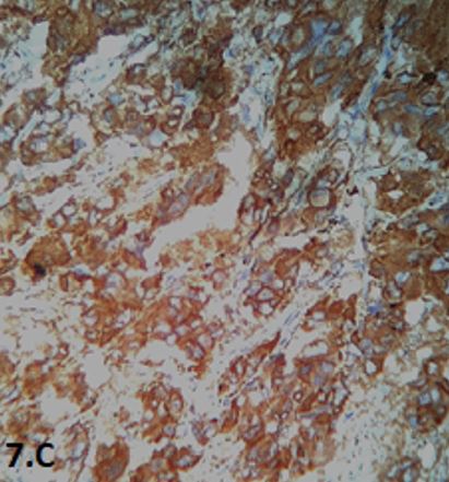 patho-680-19..JPG