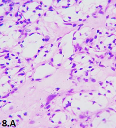 patho-680-20..JPG