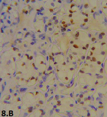 patho-680-21..JPG