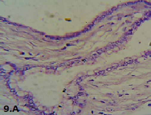 patho-680-23..JPG