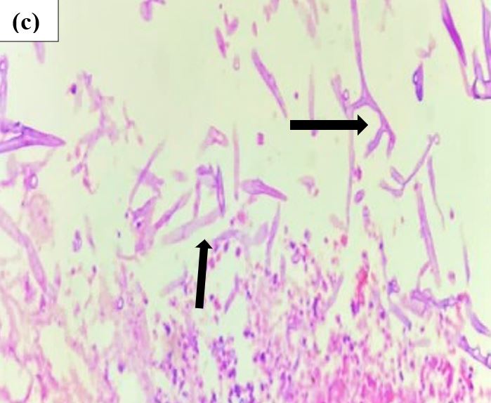 patho-683-07..JPG