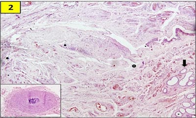 patho_406_02.jpg