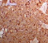 patho_418_04.jpg