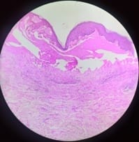 patho_470_01.jpg