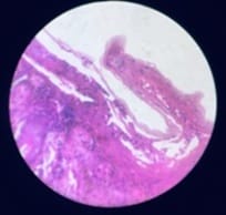 patho_470_02.jpg