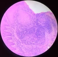 patho_470_03.jpg