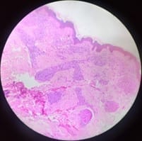 patho_470_04.jpg