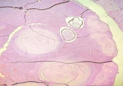 patho_644_04.JPG