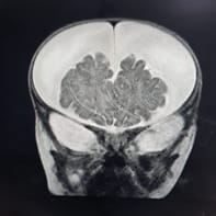 pedia_690_02.jpg