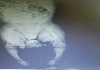 pedia_690_04.jpg