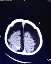 pedia_690_05.jpg