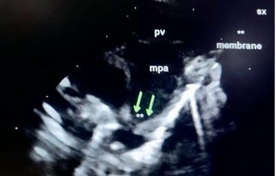 pedia_751_07.JPG