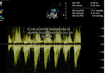 pedia_751_08.JPG