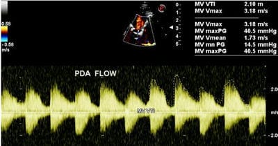 pedia_751_10.JPG
