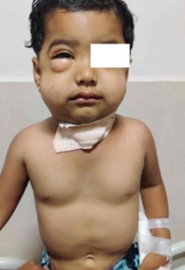 pediatric-799-01.JPG
