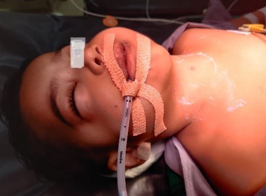 pediatric-799-03.JPG