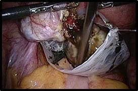 surgery_189_01.jpg