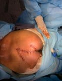 surgery_240_06.jpg