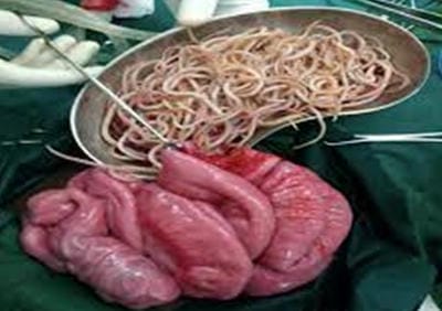 surgery_247_08.JPG