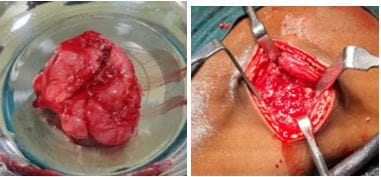 surgery_266_07.JPG