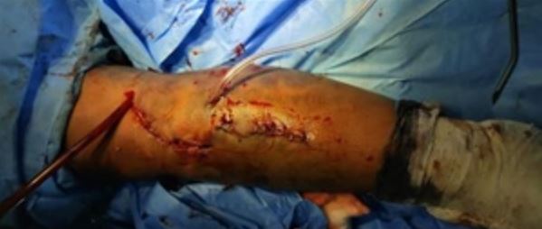 surgery_280_01.JPG