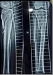 surgery_280_02.JPG