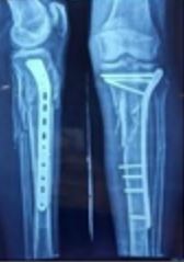 surgery_280_03.JPG