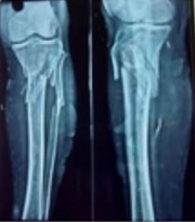 surgery_280_04.JPG