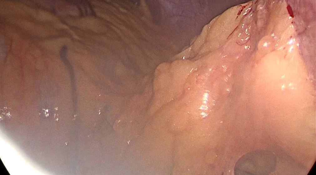 surgical-283-01.JPG