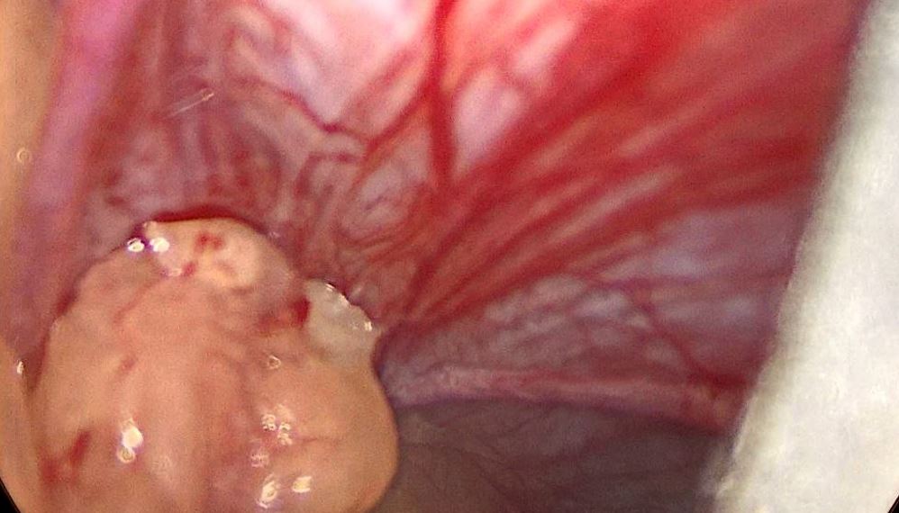 surgical-283-02.JPG
