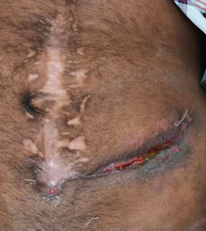 surgical-283-04.JPG