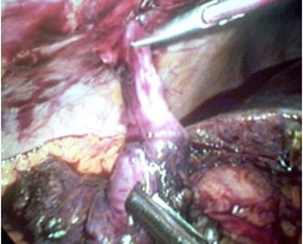 surgical_198_05.jpg