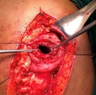 surgical_200_09.jpg